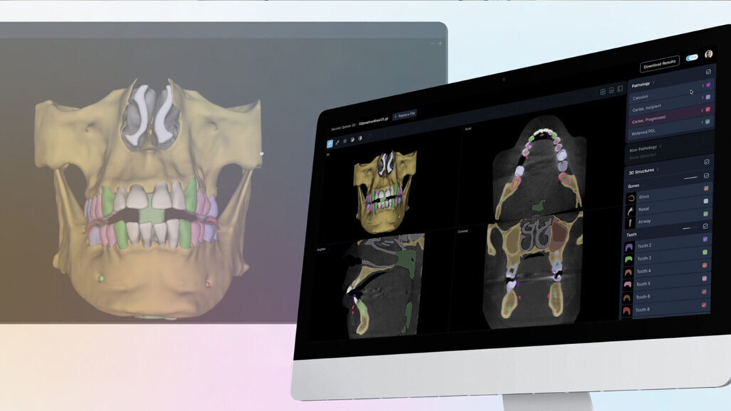 First FDA clearance granted for AI platform analyzing both 2D and 3D dental images