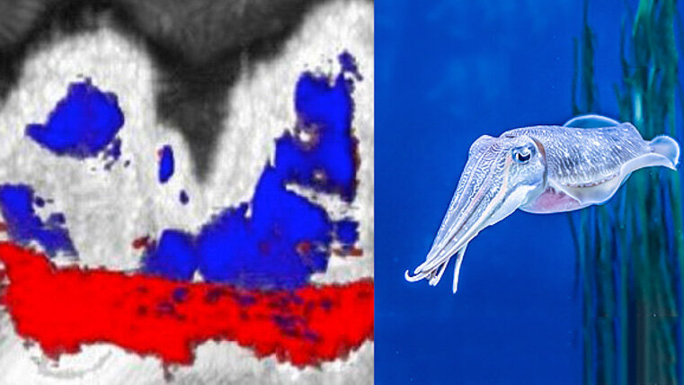 New research uses squid ink to check for periodontal disease