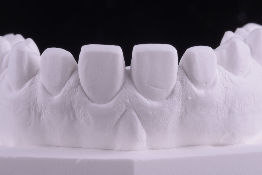 Fig. 39: Calibrated reduction completed by the laboratory and red marked areas.