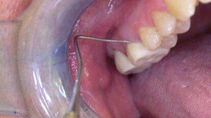 Negare l’evidenza, non aiuta a nascondere gli errori, favorisce solo il contenzioso