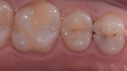 La gestione del punto di contatto nelle II classi