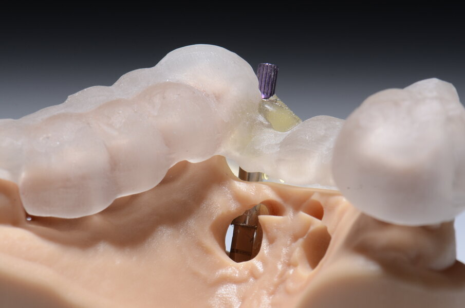 Fig. 42 - Finestre d’ispezione. 