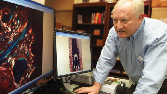 BMP improves implant success