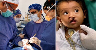 Donación de motor de implantología para cirugía de labio leporino