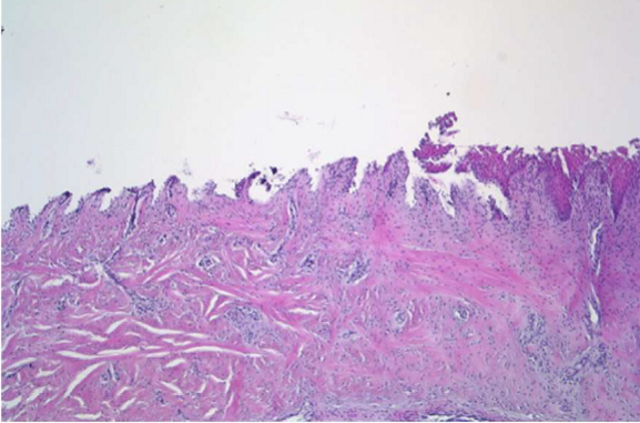 Hand Instrumentation (3)
