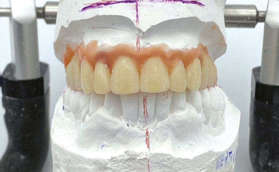Fig. 3 - Montaggio diagnostico.