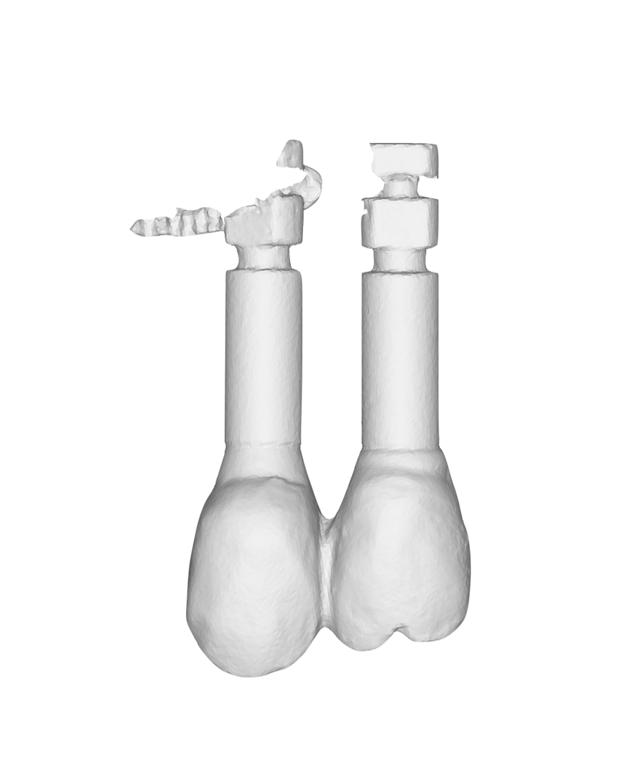 Fig. 6_File STL del provvisorio. 