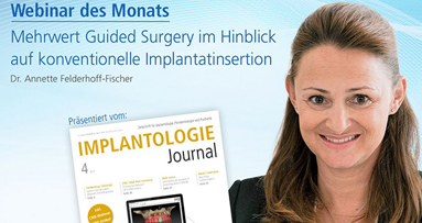 Webinar: Mehrwert von Guided Surgery
