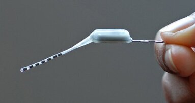 Mini-Stimulator im Oberkiefer schaltet Kopfschmerzen ab