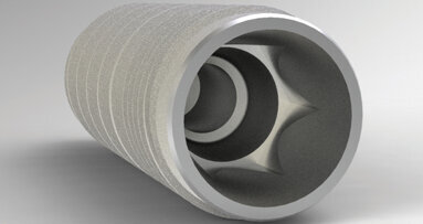 Champions Implants: An ideal solution for the general dentist