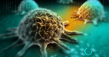 Mundkrebserkennung durch Zahnärzte steigt rapide