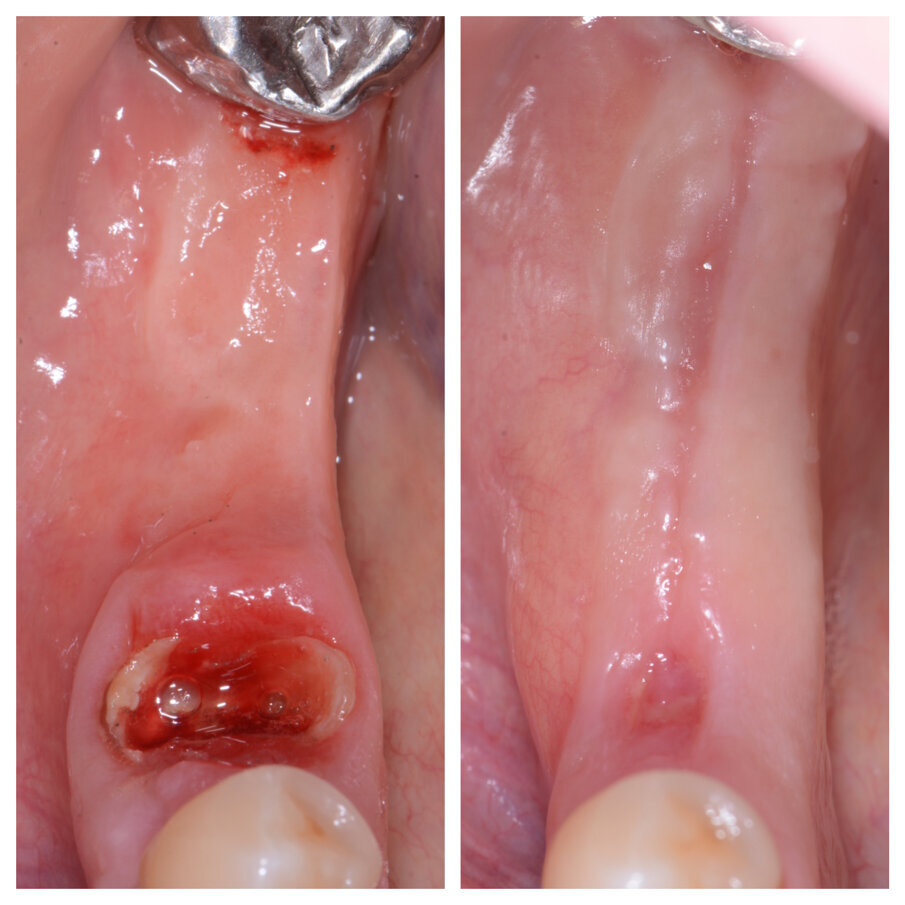 Fig. 3b_Cambiamento dei tessuti a 27 giorni.