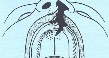 Recenti sviluppi sulla Genetica delle Schisi Orofacciali