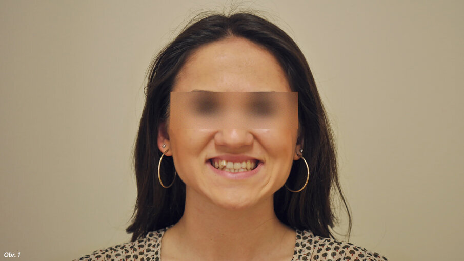 Extraorální fotografie počátečního stavu pacientky.