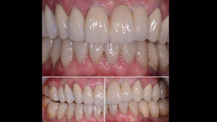 Fig. 10 - Consegna lavoro definitivo.