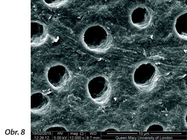 Obr. 8: Otevřené kanálky na povrchu dentinu (výzkum na Queen Mary University of London).
