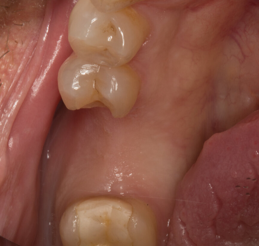 Ryc. 1_Stan przed przystąpieniem do zabiegu chirurgicznego.