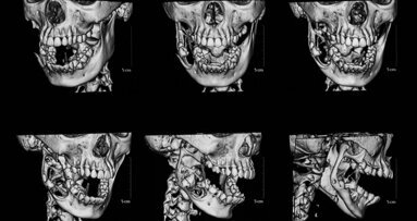 Orthodontic treatment planning without radiation exposure