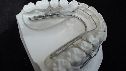 Ethical smile design with the Inman Aligner―A case study