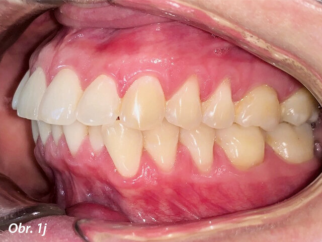 Pacientka 1 – Počáteční fotografie.