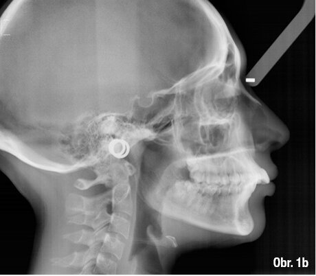 Kazuistika - popis v textu