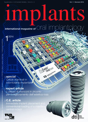 implants Italy No. 1, 2014 implants Italy No. 1, 2014