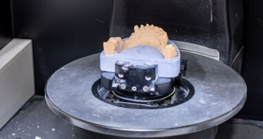 Implant planning made easier with 3D-printed shell complete dentures