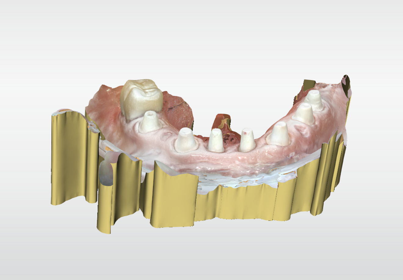 Fig. 14: Digital impression using titanium dioxide powder.
