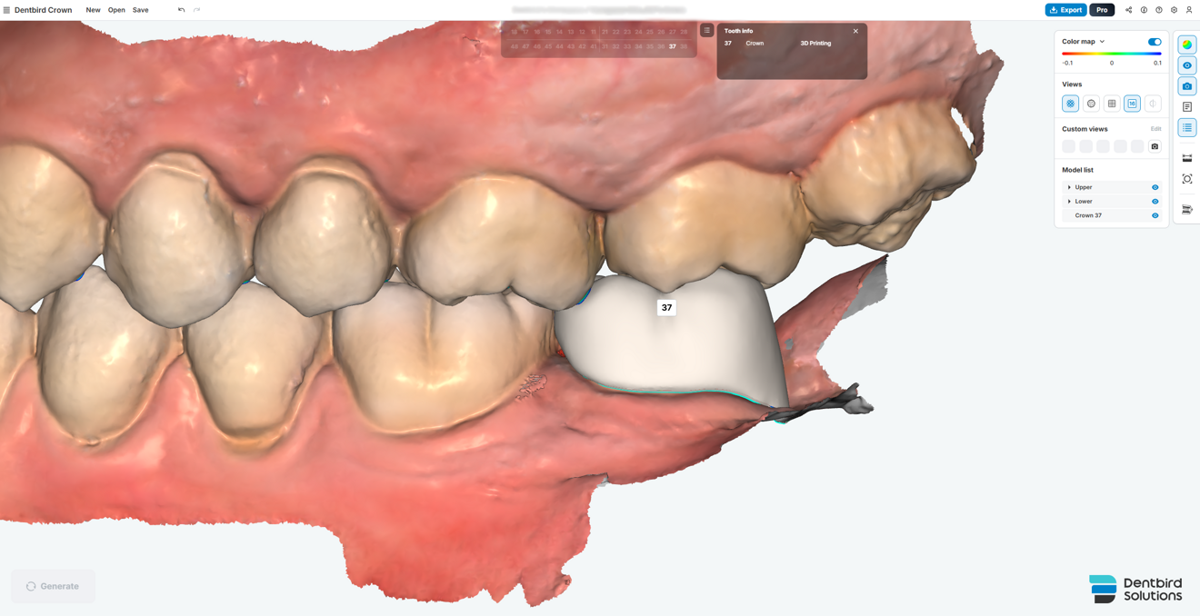 Fig. 4c: Observation of the occlusion and contour from the buccal view.
