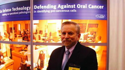 OralCDx test tissues for oral cancer