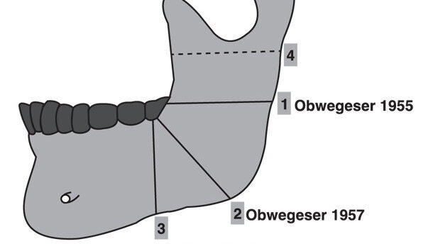 Orthodontic surgery and aesthetics
