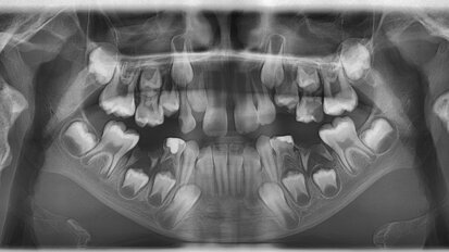 Przyszłość radiologii stomatologicznej