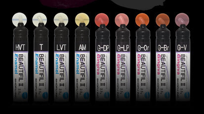 Pink & White Aesthetics with BEAUTIFIL II