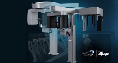 Alliage adquiere la empresa japonesa PreXion