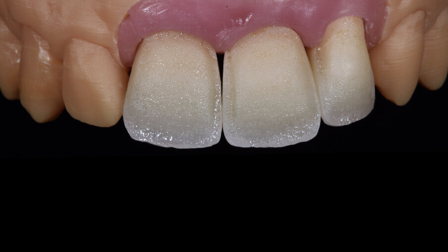 Fig. 8_Risultato del Wash.