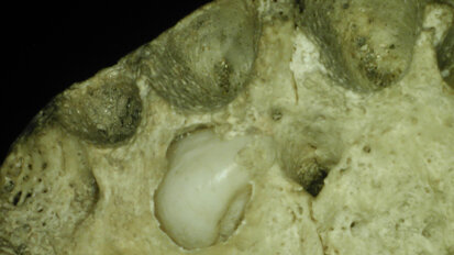 Un caso di iperdontia in un reperto di epoca tardo romana proveniente dalla grotta-ossario di Susa (To)