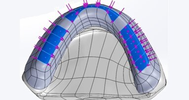 Numeryczna weryfikacja problematyki mocowania protezy całkowitej wspartej o implant