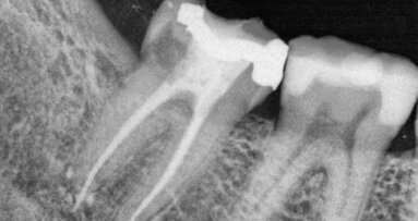 Jak se dostat do bodu 00.00