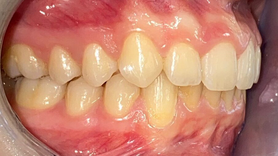Fig. 19_Laterale destra post-trattamento.