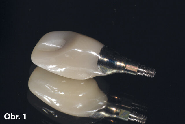 Chrom-kobaltové frézované abutmenty