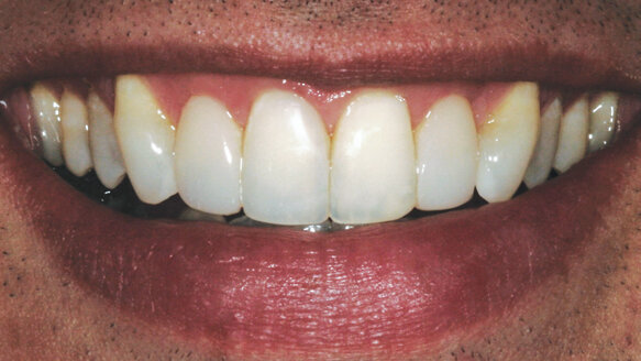 A banker’s bond: When less is more