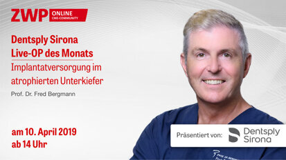 Am 10. April einschalten: Dentsply Sirona Live-OP mit Prof. Dr. Bergmann Am 10. April einschalten: Dentsply Sirona Live-OP mit Prof. Dr. Bergmann