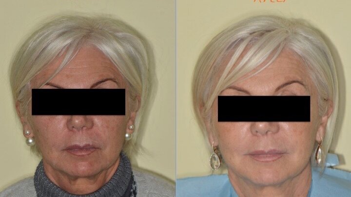 Caso di estetica multidisciplinare