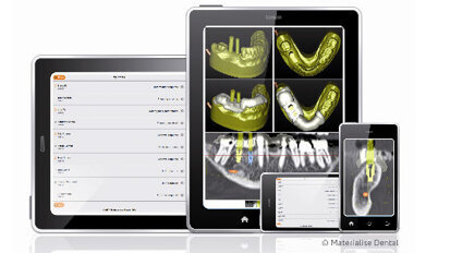 Consegna della guida chirurgica più rapida e senza intoppi per una migliore esperienza da parte del cliente