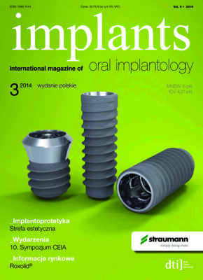 implants Poland No. 3, 2014 implants Poland No. 3, 2014