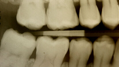 Armonia estetica funzionale e posturale con il nuovo materiale Enamel Plus Hri Bio Function