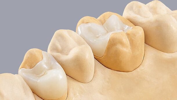 CAD/CAM, la tecnología que está revolucionando la industria dental (2)