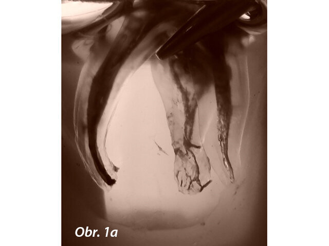 Obr. 1a, b: Složitost anatomie kořenových kanálků je zachycena na těchto projasněných ukázkách horních molárů