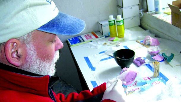 Nepal-Zähne könnten Rätsel um Entstehung von Lippen-Kiefer-Gaumenspalte lösen