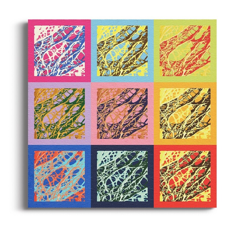 Scanning electron photomicrographs reveal the collagen bundles in Striate+, presented in the style of Andy Warhol’s Marilyn Diptych.